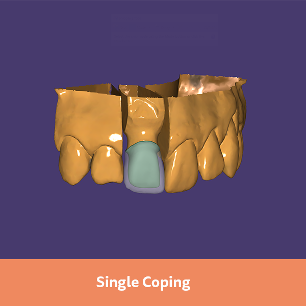 Exocad Viewer Free, how to import files Exocad Viewer Free, offline repository setup for resilient backups