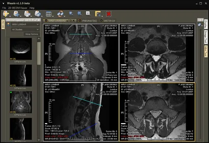 JDicom, why does it fail JDicom, restore testing plan for critical clinic files