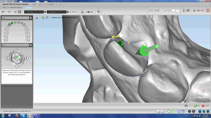 OrthoStudio Free, how to recover a project OrthoStudio Free, data protection checklist with encryption and repositories