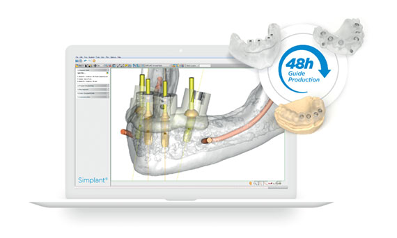 SimPlant Demo Viewer, how to recover a project SimPlant Demo Viewer, data protection checklist with encryption and repositories